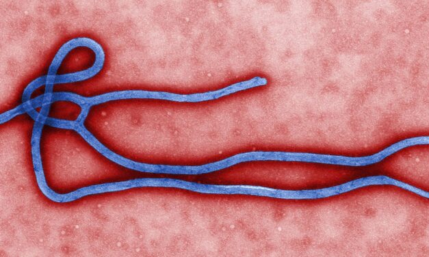 Ebola, rete sanitaria pronta: coinvolta anche la Asl di Teramo