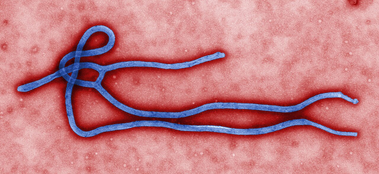 Ebola, rete sanitaria pronta: coinvolta anche la Asl di Teramo