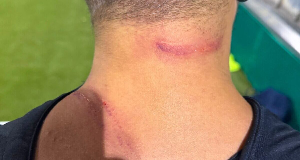 Sant’Omero, arbitro colpito durante un torneo a Poggio Morello